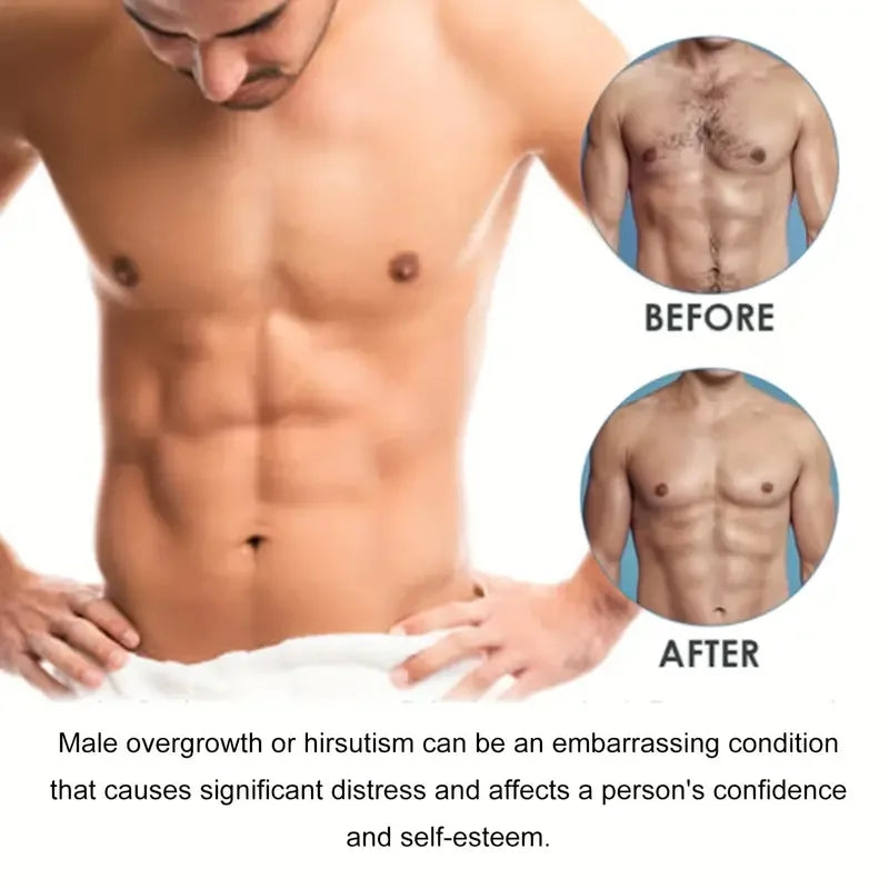RYZECLEAR™ – Men’s Hair Removal with SmoothRoot™ Technology