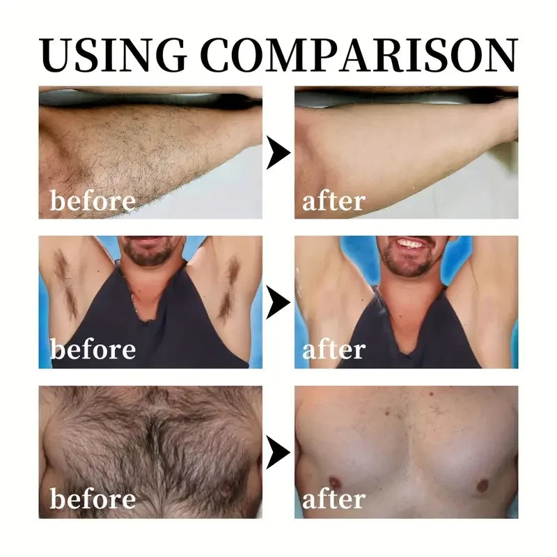 RYZECLEAR™ – Men’s Hair Removal with SmoothRoot™ Technology